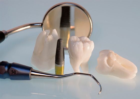 Consulta Odontológica Gorka Ibarlucea dientes e implantes con herramientas dentales 