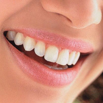 Consulta Odontológica Gorka Ibarlucea mujer sonriendo 